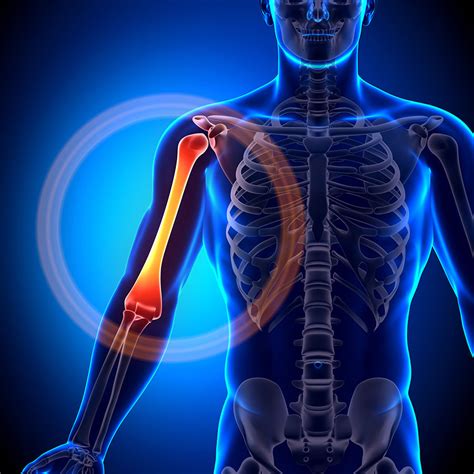 upper arm muscle rupture treatment